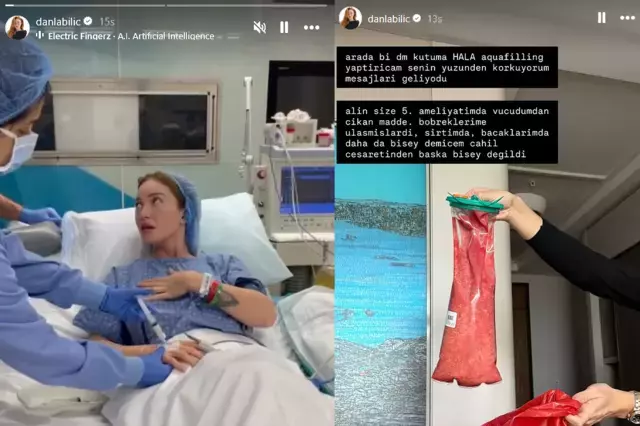 Danla Bilic 5. kez bıçak altına yattı! Vücudundan çıkan dolgu maddesini yayınladı