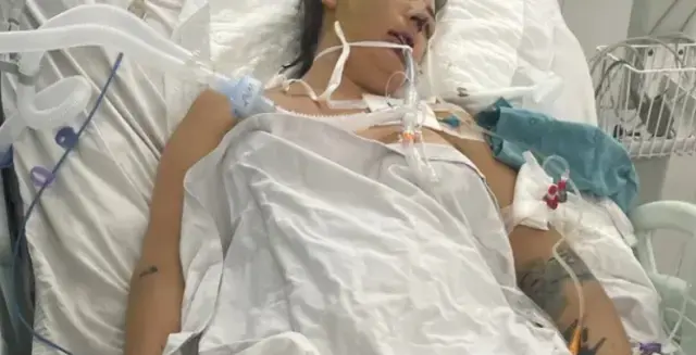 Tatil için gittiği ülkede kabusu yaşadı! Yoğun bakımda yaşam savaşı veriyor